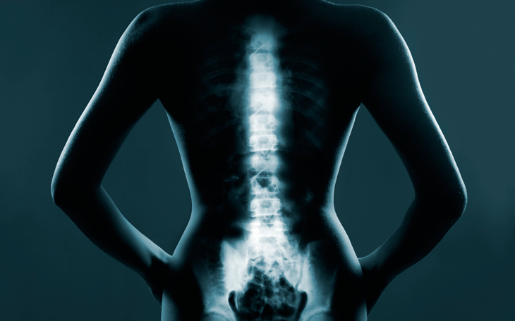 coluna-vertebral-capa