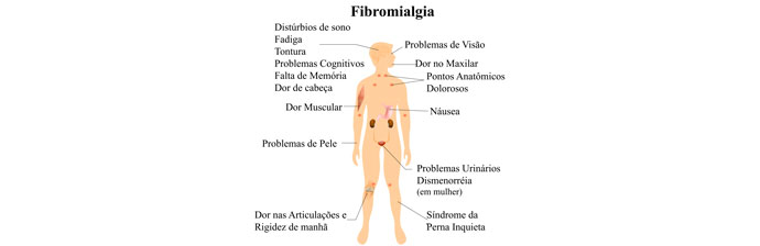 Sintomas da Fibromialgia