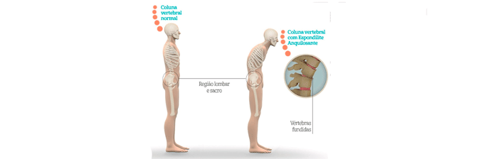 coluna-vertebral-7