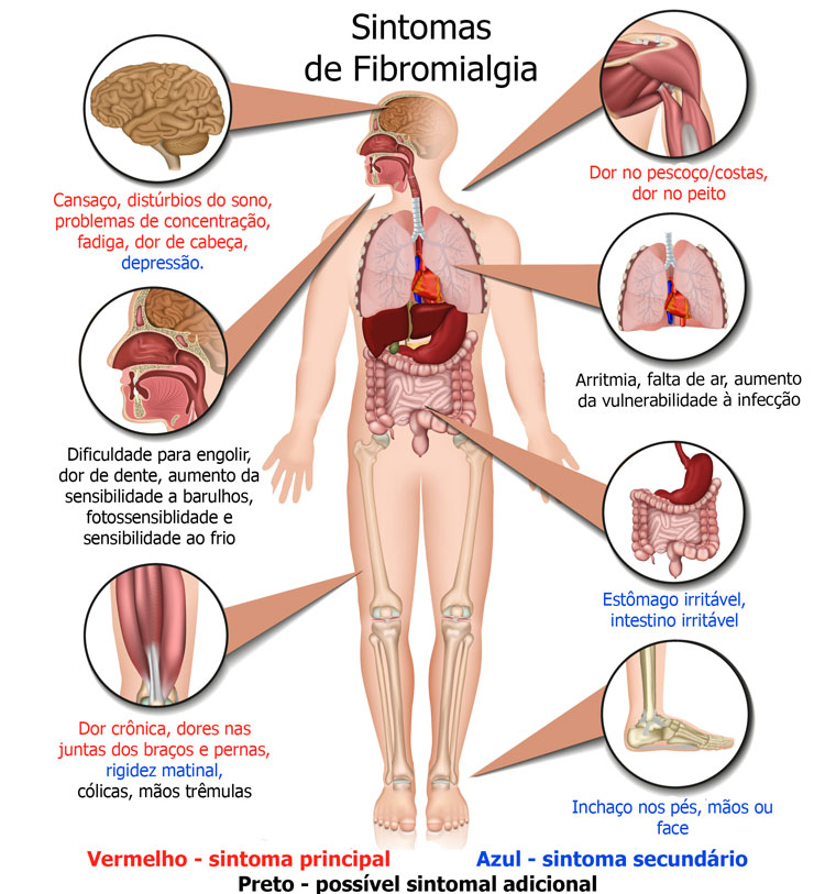terapia manual para fibromialgia