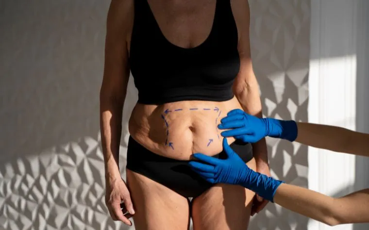 Relevância da atuação fisioterapêutica no pré e pós da cirurgia bariátrica