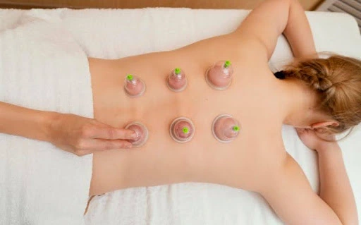 Ventosaterapia para profissionais: sensação, aplicação e resultados reais